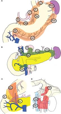 Significance of Lymph Node Metastasis in the Treatment of Gastric Cancer and Current Challenges in Determining the Extent of Metastasis